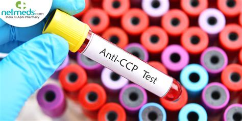 Anti CCP Test .